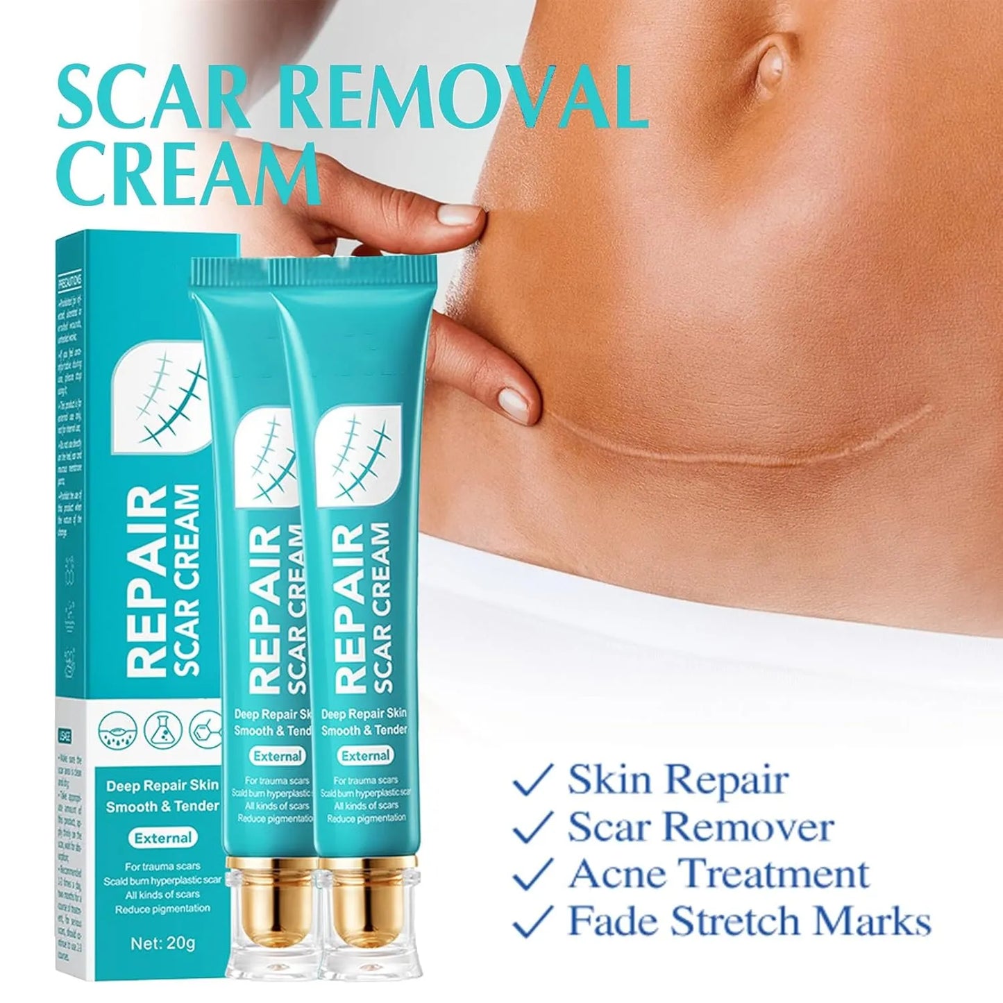 🔥Ostatni dzień 50% zniżki – 🩹Krem do naprawy blizn Alcuras® Advanced Scar Repair Cream✨
