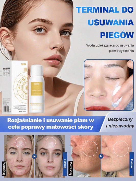 Różne plamy znikają Spray wybielający do usuwania plam
